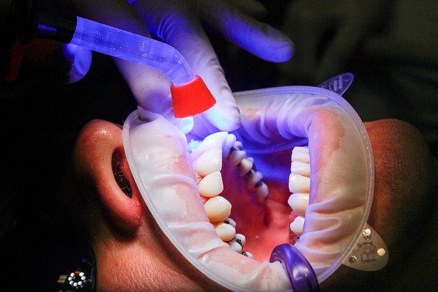 Implantati